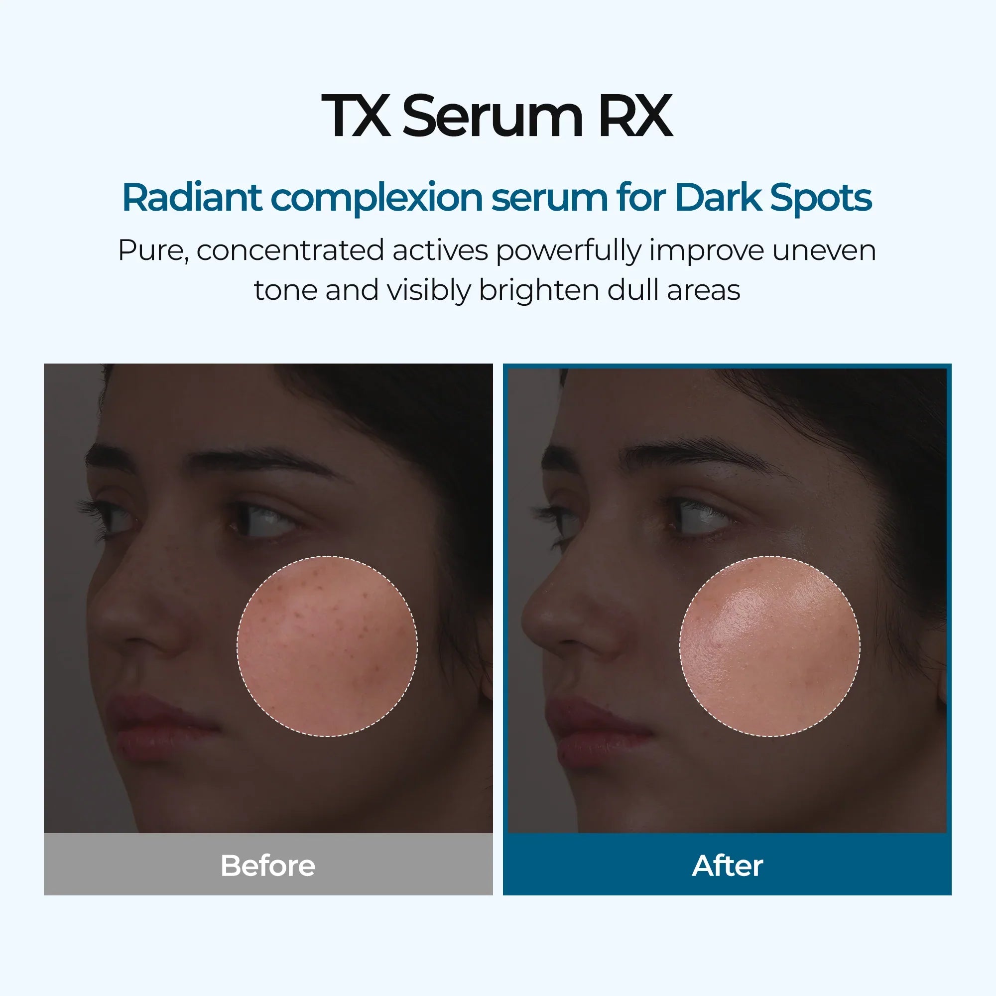 TX Ampoule Rx